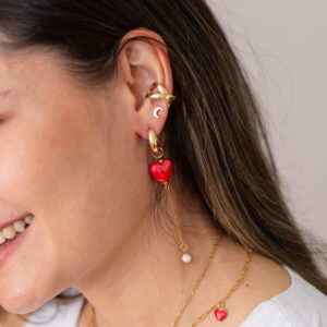 Aretes